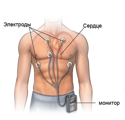 holter