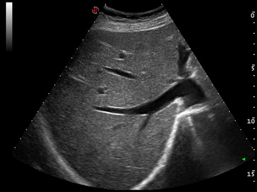 mylab six cl high definition abdominal imaging 01